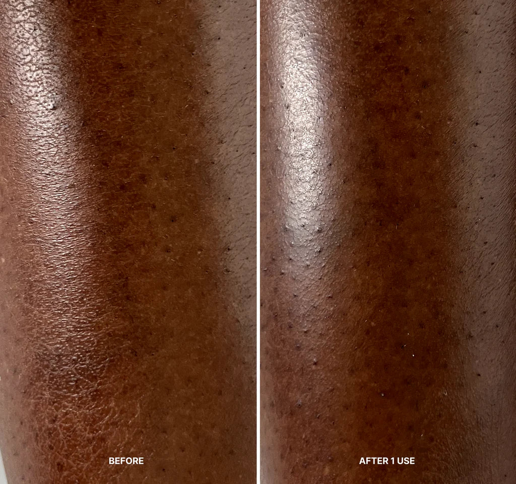 LILIS INSTANT PEEL