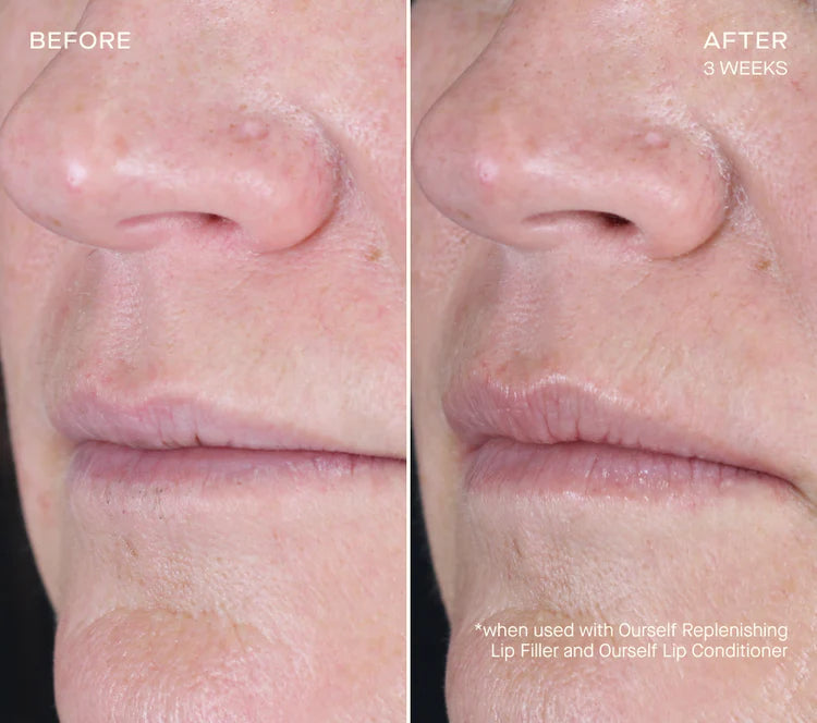REPLENISHING LIP FILLER 1.7mL