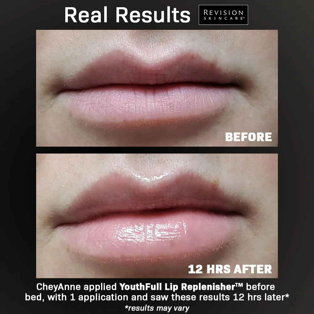 YouthFull Lip Replenisher® .33 oz