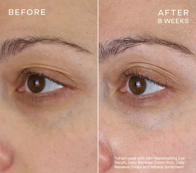HA+ REPLENISHING EYE SERUM 16.5 mL